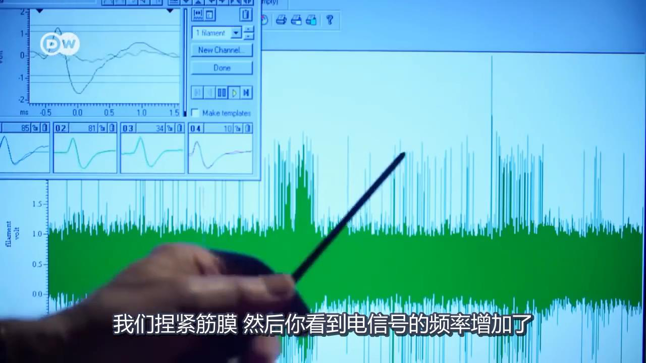 筋膜信號(hào)